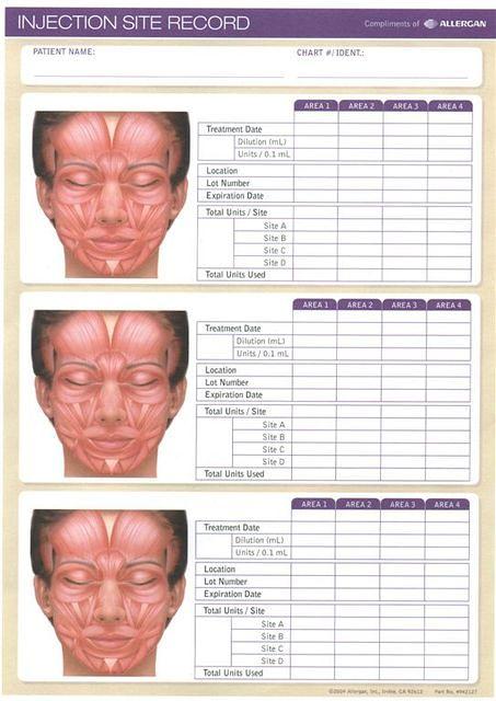 Allergan's Injection Site Record