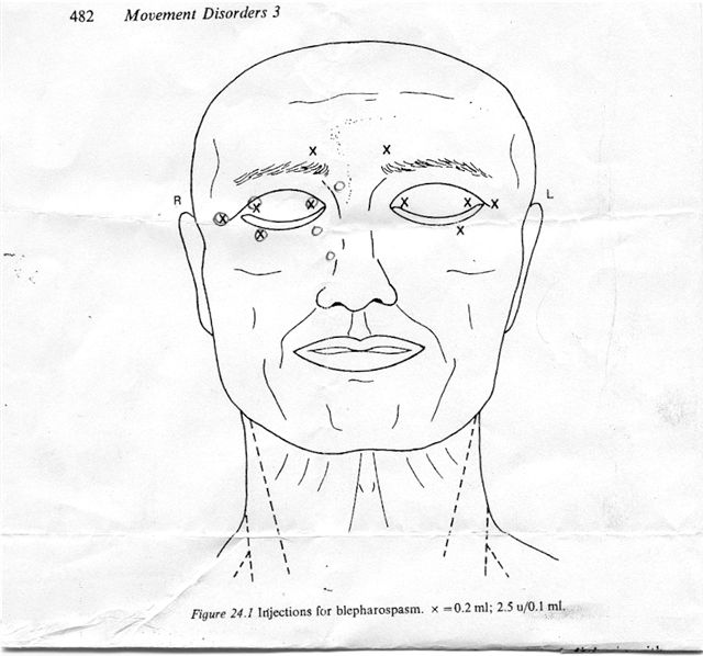 Injection Site Chart