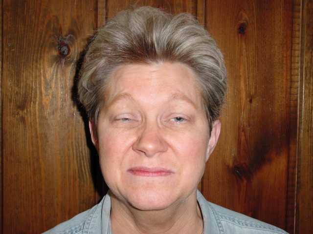 Shirley Barr Pre-Operative