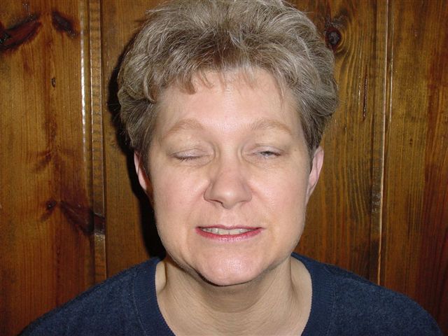 Shirley Barr Pre-operative