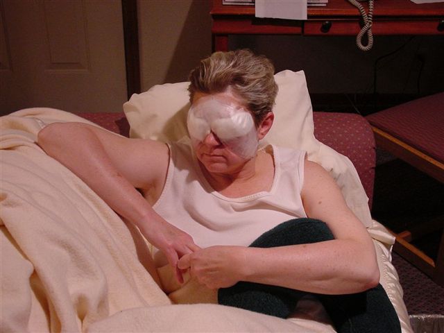 Day After Surgery
