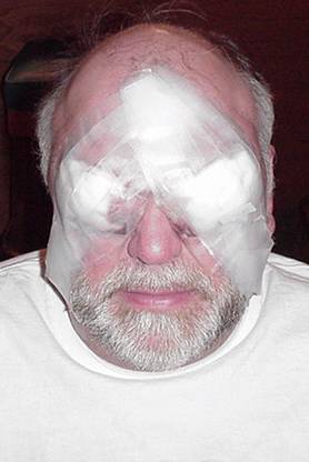 Steve Stephens 1st Day After Surgery