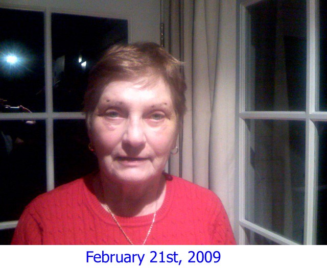 8 Days Post-Op
