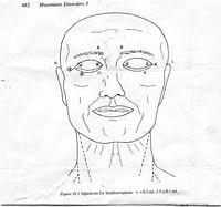 Injection Site Chart