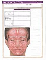 allerganinjectionsiterecord