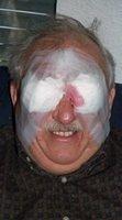 Eyes Bandaged