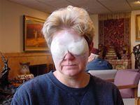 Shirley Barr 3rd Day Post-operative