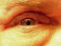24 Days After Surgery