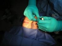 Beginning Procedure