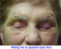 Front View Squeezing Eyes Closed